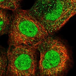 Dystonin Antibody, Novus Biologicals 25 &mu;L; Unlabeled:Antibodies, Polyclonal